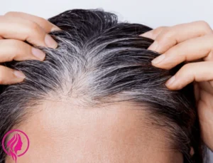 white hair,why do we get white hair,white hair removal,white hair to black hair naturally,laser white hair removal treatment,white hair permanent removal by electrolysis.,electrolysis white hair removal near me,white hair removal by electrolysis,grey hair,white hair in young age,premature white hair home remedies,white hair treatment,reason of white hair in young age,how does electrolysis work to remove hair?,why do we get white hair at young age,la canitie