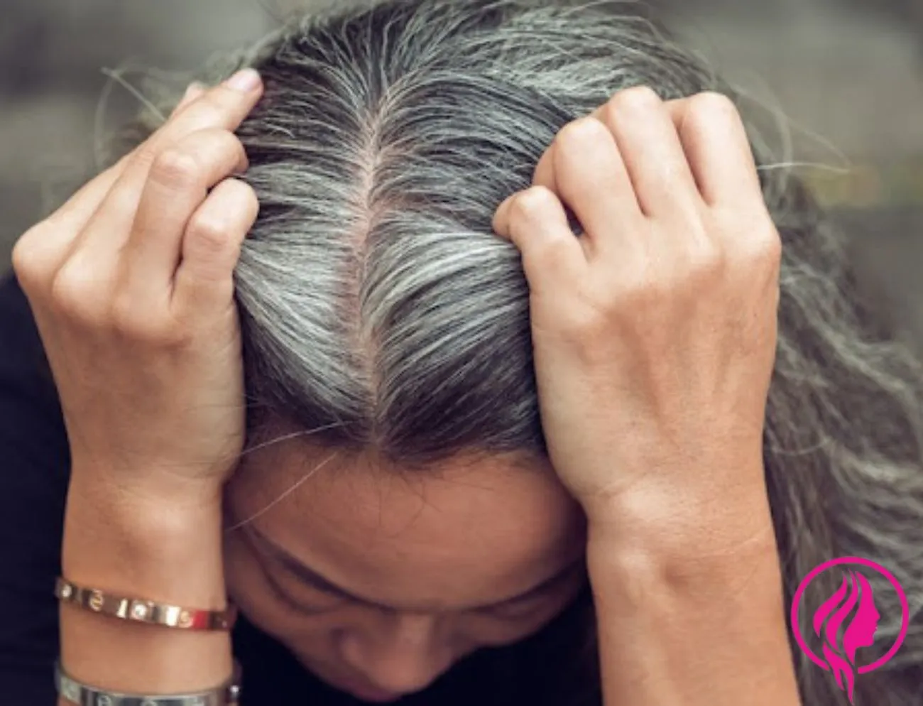 white hair,why do we get white hair,white hair removal,white hair to black hair naturally,laser white hair removal treatment,white hair permanent removal by electrolysis.,electrolysis white hair removal near me,white hair removal by electrolysis,grey hair,white hair in young age,premature white hair home remedies,white hair treatment,reason of white hair in young age,how does electrolysis work to remove hair?,why do we get white hair at young age