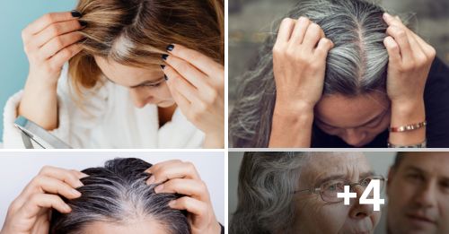 white hair,why do we get white hair,white hair removal,white hair to black hair naturally,laser white hair removal treatment,white hair permanent removal by electrolysis.,electrolysis white hair removal near me,white hair removal by electrolysis,grey hair,white hair in young age,premature white hair home remedies,white hair treatment,reason of white hair in young age,how does electrolysis work to remove hair?,why do we get white hair at young age,Canitie,